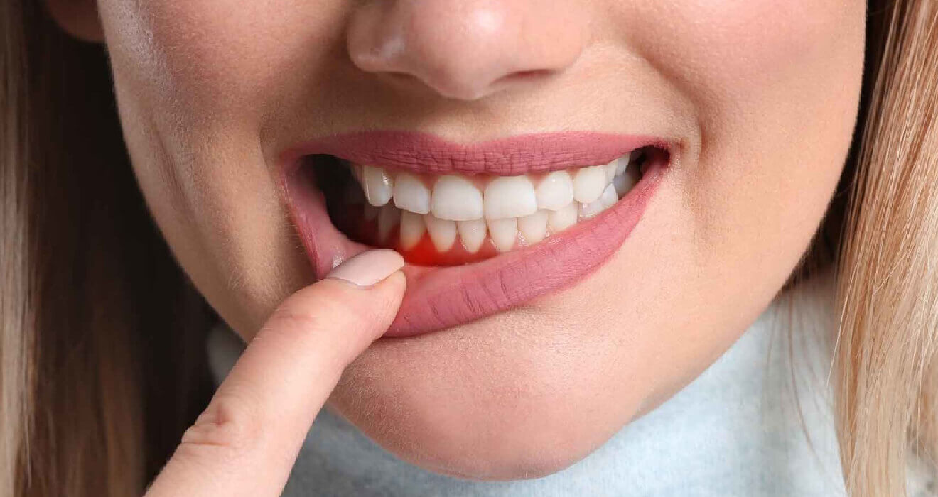 What You Need To Know About Gum Therapy